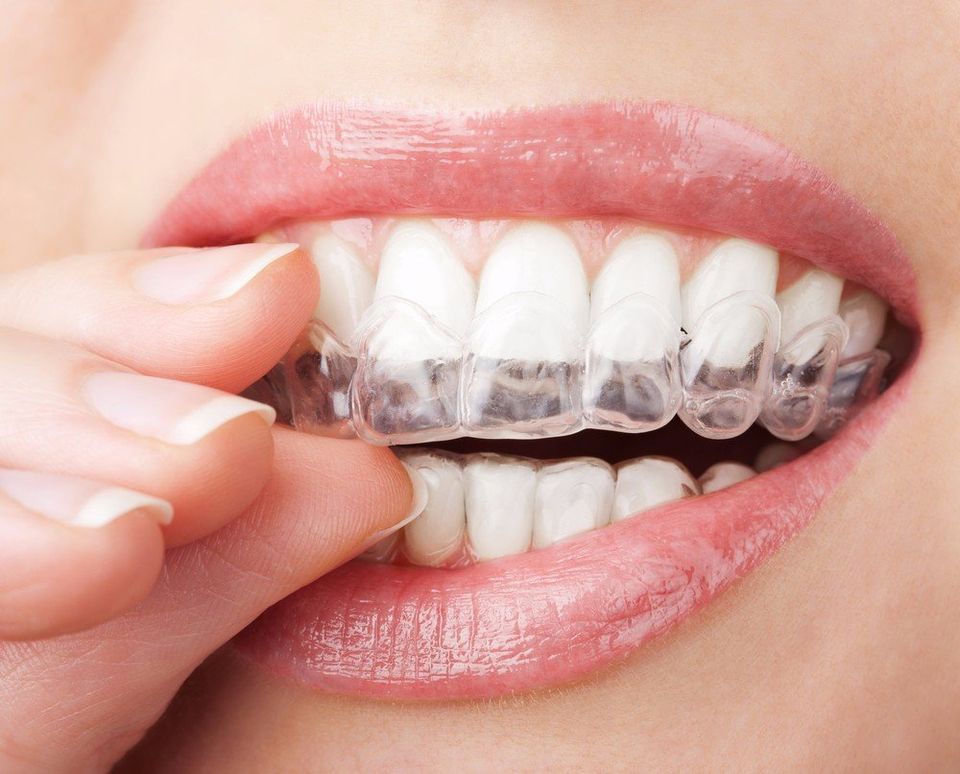 teeth bleaching, sensitive teeth
